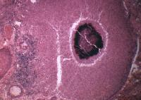 Actinomycetes sulfur granule